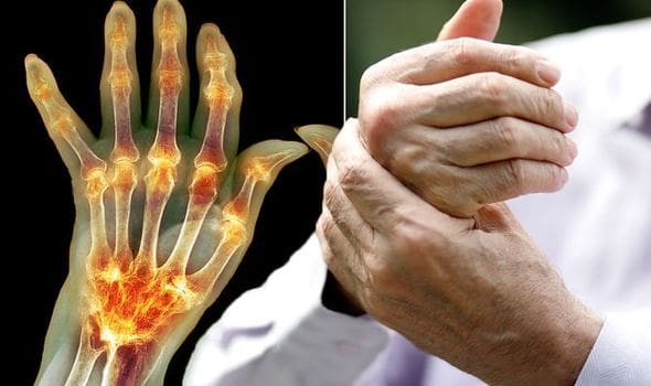Arthritis-pain-joint-pain-bunion-pain-muscle-pain